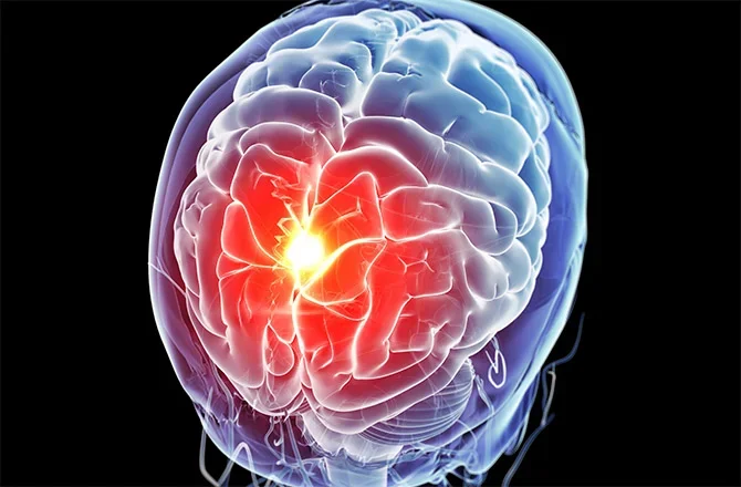 cannabis-brain-changes-670x440-141123.webp